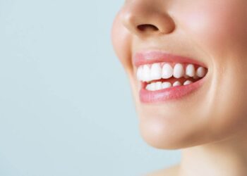 Cara Merapikan Gigi Tanpa Behel Secara Alami